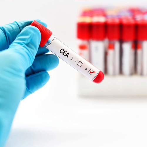 Tampa Carcinoembryonic Antigen Test - CEA Tests - 24/7 Labs