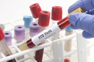 Read more about the article 3 Important Reasons to Get Tested for STDs