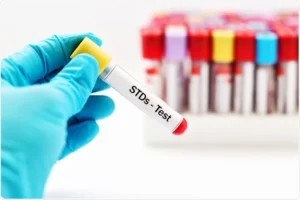 Read more about the article Can STDs Be Treated? Here’s What You Should Know