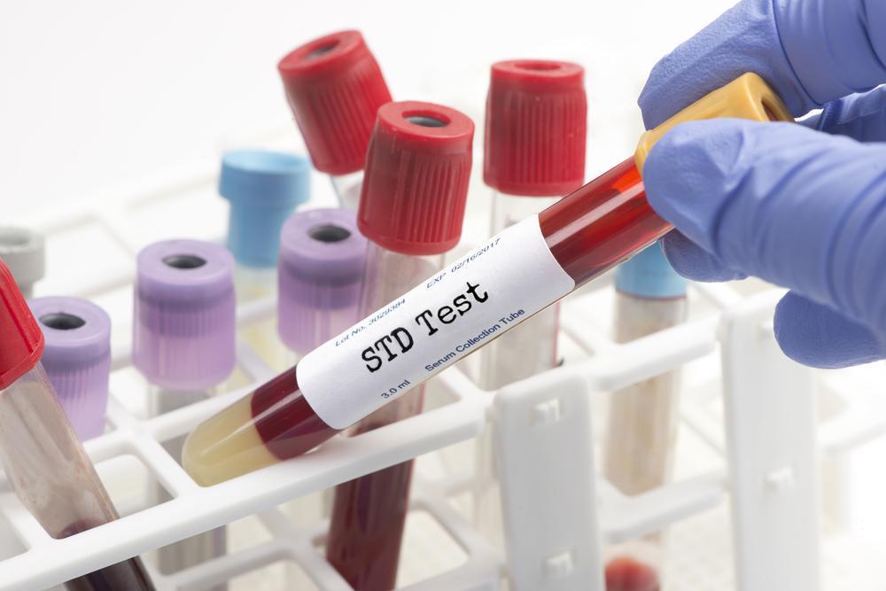Read more about the article How Often Should You Get Tested for STDs?: Your Complete Guide