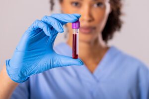 Read more about the article Why You Should Test for Anemia if You Have PCOD