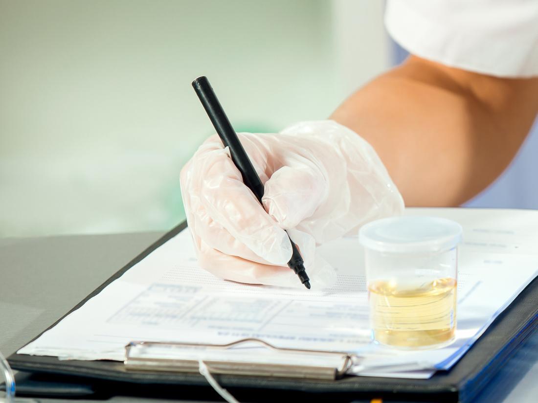 Read more about the article Want To Keep Your Workplace Safer? Get Your Employees Drug Tested!