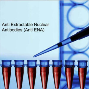 Anti-extractable Nuclear (A/g)