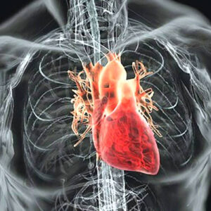 High Sensativity Cardiac Risk