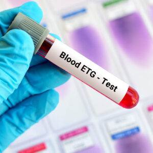 Blood 5 Panel Drug Test